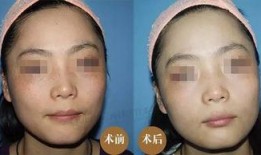 徒手祛斑爆料视频大全图片,视频大全图片解析